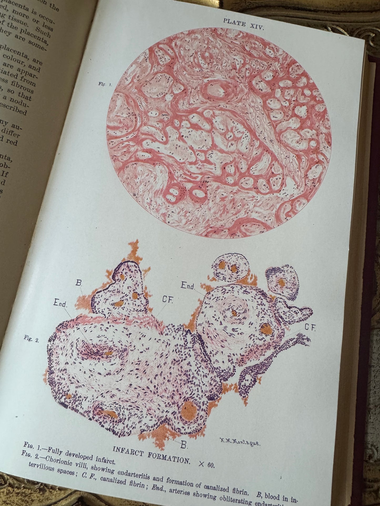 Obstetrics 
A Text-Book for the Use of Students and Practitioners
by J. Whitridge Williams
©️1904