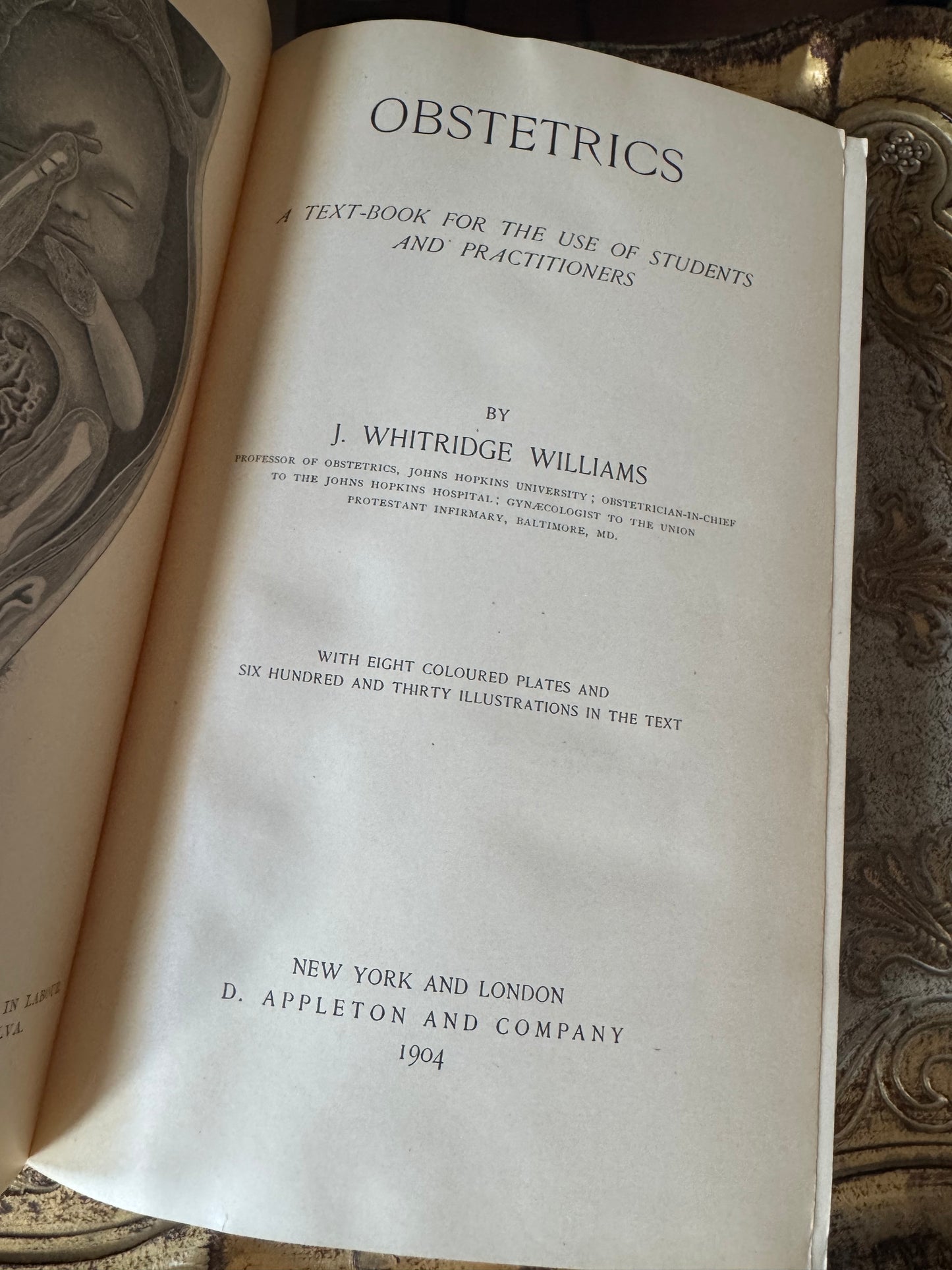 Obstetrics 
A Text-Book for the Use of Students and Practitioners
by J. Whitridge Williams
©️1904